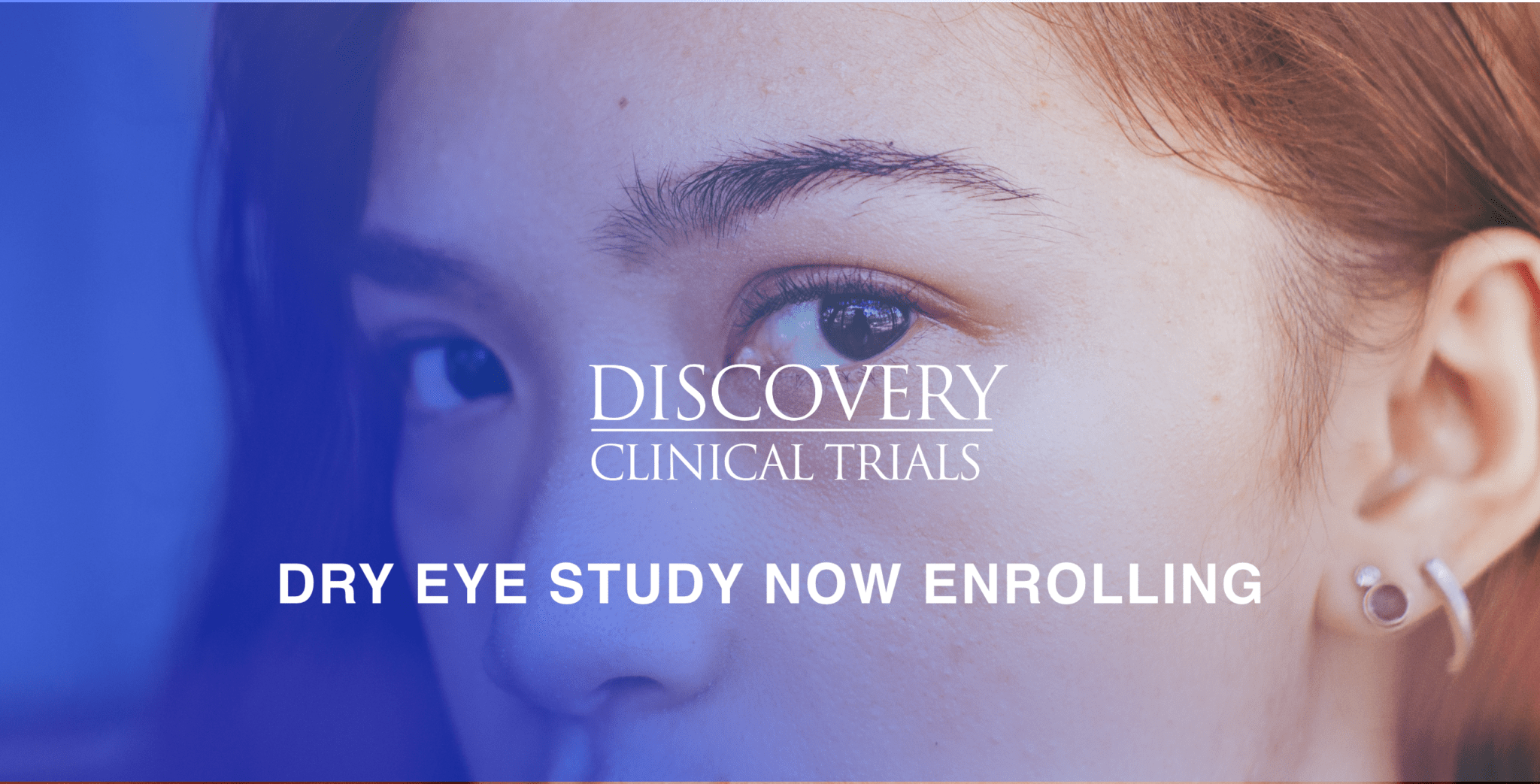 dry-eye-landing-page-header dry-eye-landing-page-header