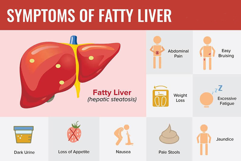 WHAT-ARE-THE-SYMPTOMS-OF-NAFLD-2-1