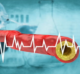 Cardiovascular (ASCVD)